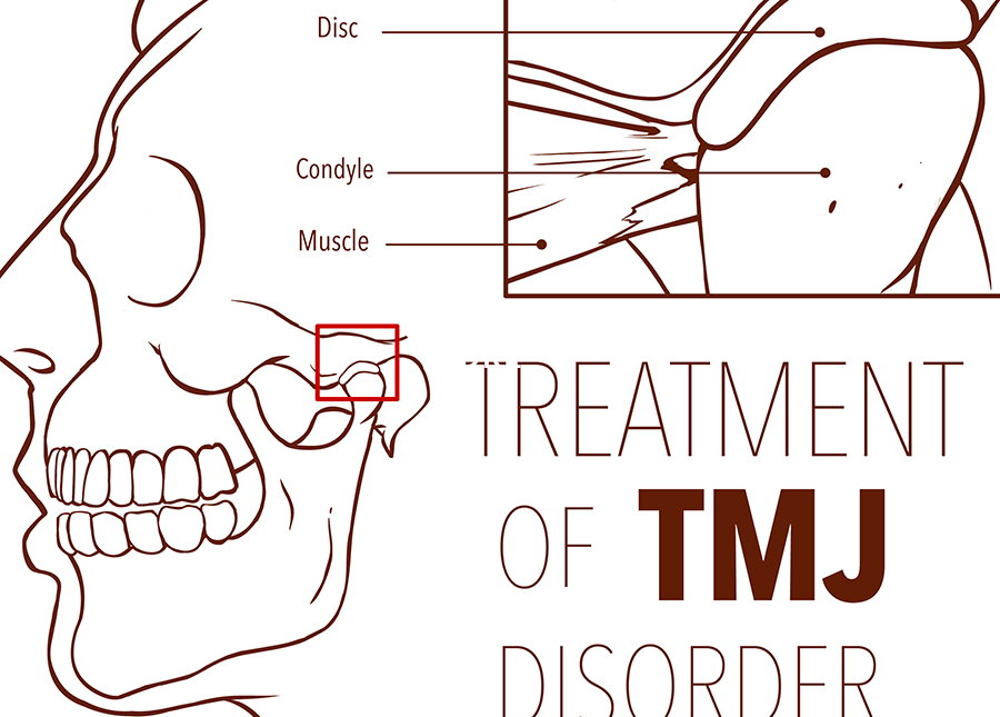 顳顎關節盤移位(TMJDiscDisplacement)對顏面歪斜